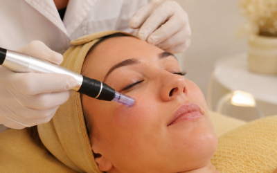 Bones pràctiques de microneedling per a professionals d’estètica